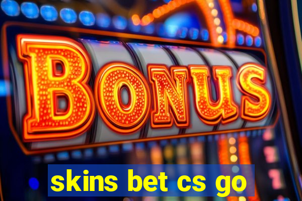 skins bet cs go