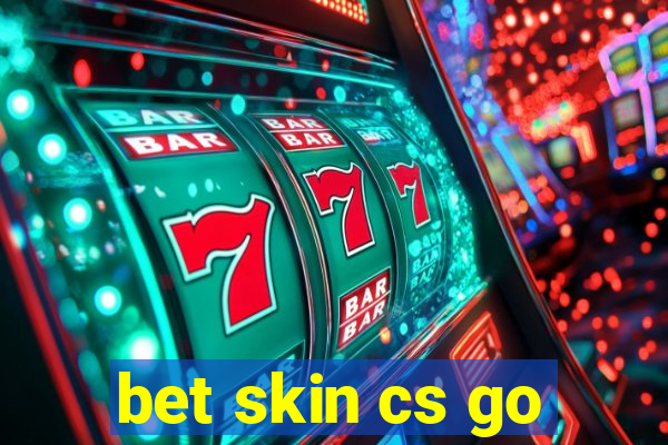 bet skin cs go